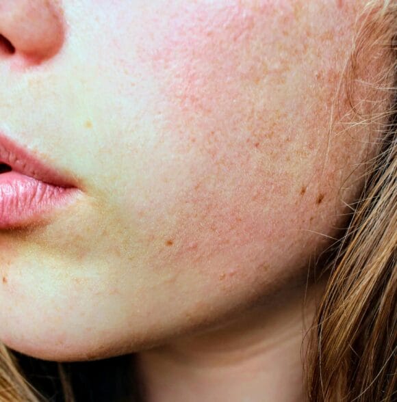 Poliklinika za dermatologiju i venerologiju Zagreb