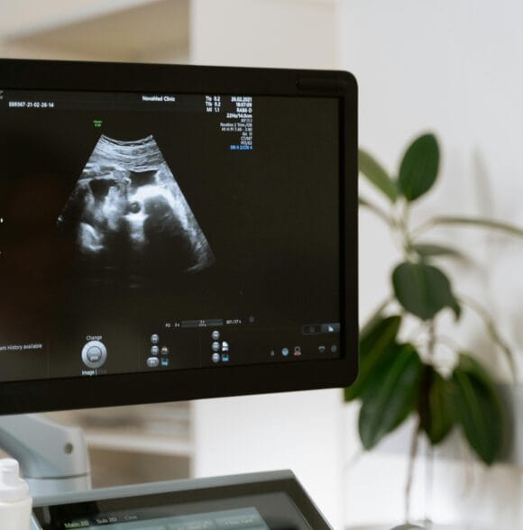 Ginekološki pregled, ultrazvuk, papa test, trodimenzionalni ultrazvuk Zagreb