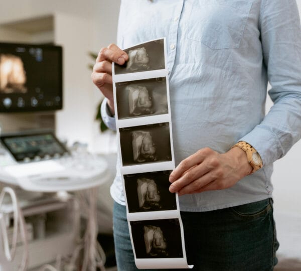 Ginekološki pregled, ultrazvuk i papa test Zagreb